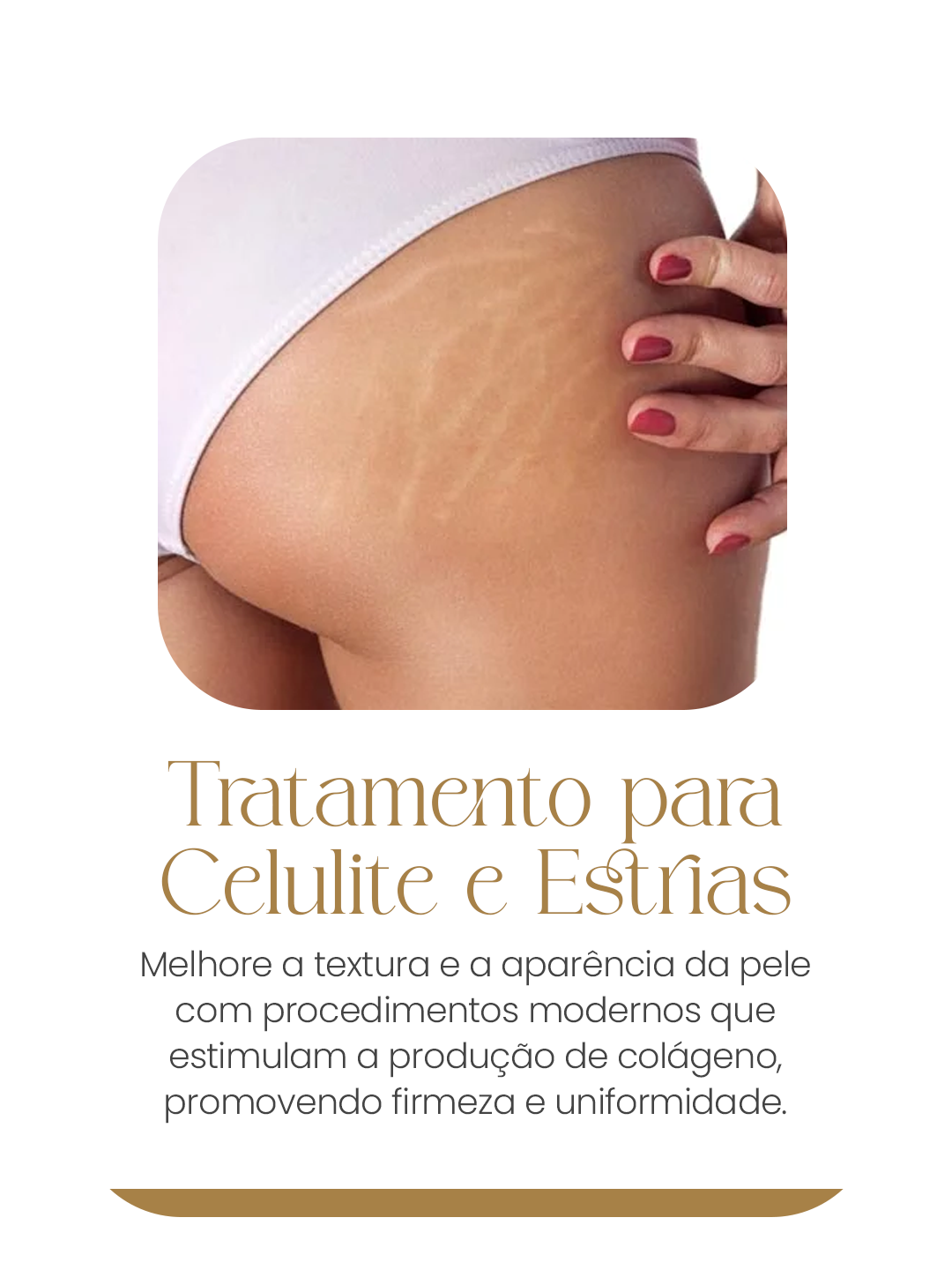 celulite mobile