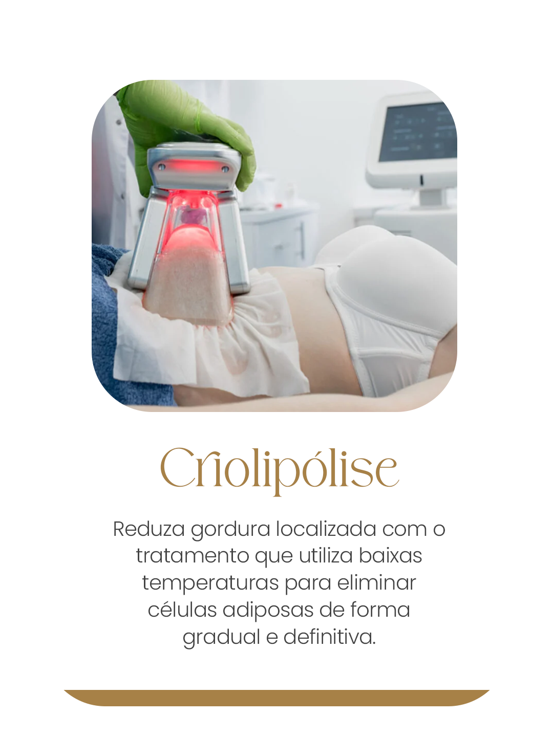 criolipólise mobile