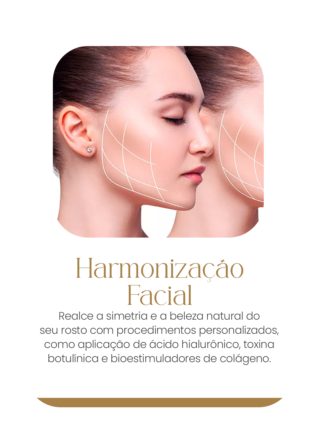 harmonização mobile