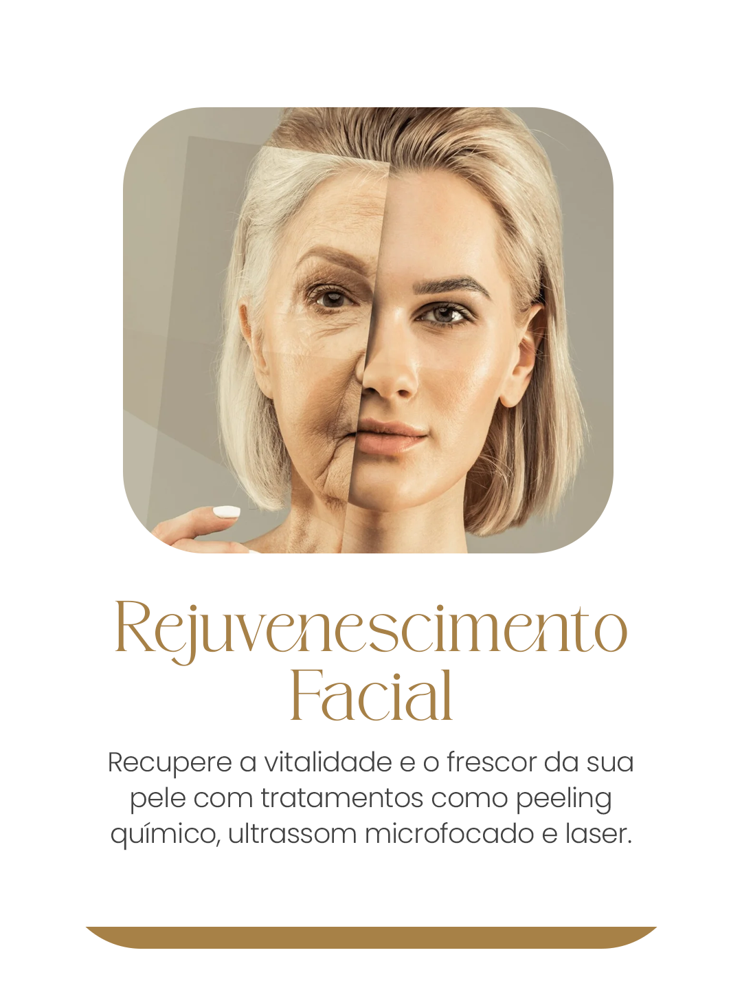rejuvenescimento mobile